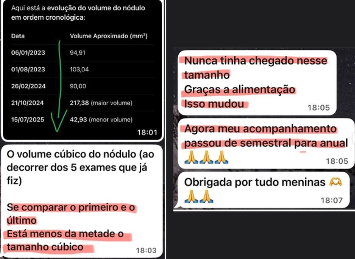 Mensagens de paciente com a tabela do volume do nódulo em 5 exames, de 2023 a 2025: o último exame mostra menos da metade do volume do primeiro